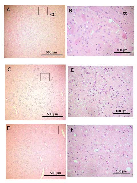 Figura 5. Ncleo caudado-putamen. Controles (A,B). Zona de infarto con presencia de macrfagos de mayor extensin en animales isqumicos tratados con vehculo (C, D) que en los tratados con EPOhr-bas (E,F). Las imgenes de la derecha corresponden al rea dentro del cuadro de la imagen izquierda. cc: cuerpo calloso. Hematoxilina - Eosina.